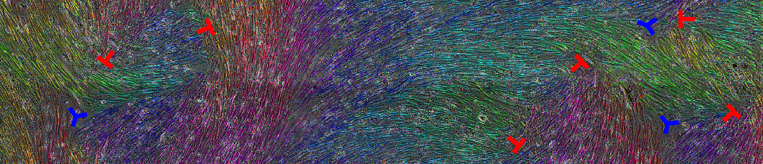cell alignment and topological defects